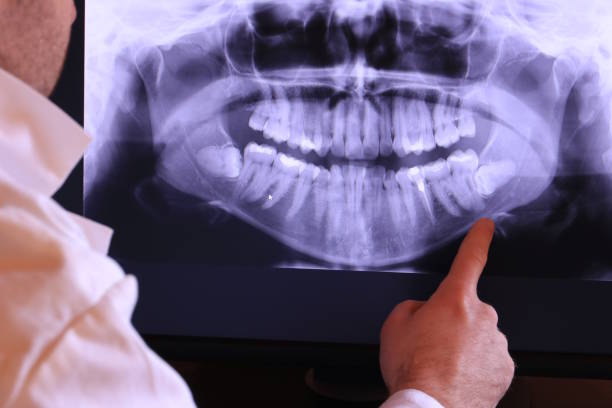 Best Broken or Chipped Tooth Repair in Kaloko, HI